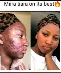 Miira-Tiara Testimony